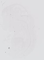EMAGE:14004