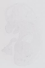 EMAGE:14004