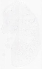 EMAGE:14015