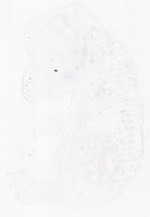 EMAGE:14015