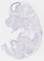 EMAGE:14047