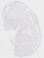 EMAGE:14059