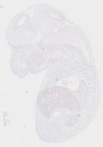 EMAGE:14064