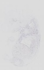EMAGE:14065