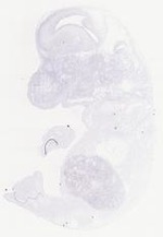 EMAGE:14066