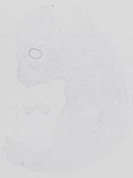 EMAGE:14075
