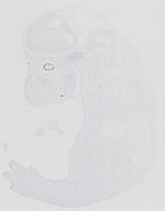 EMAGE:14076