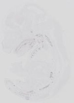 EMAGE:14077
