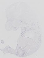 EMAGE:14077