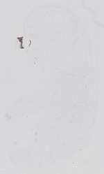 EMAGE:14079
