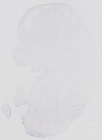 EMAGE:14101