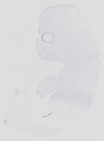 EMAGE:14101