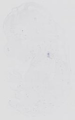 EMAGE:14114