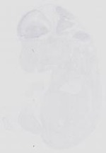 EMAGE:14115