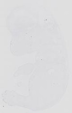 EMAGE:14115