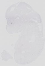 EMAGE:14118