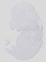 EMAGE:14139
