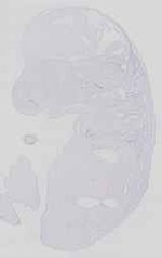 EMAGE:14142