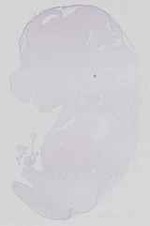 EMAGE:14142