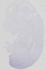 EMAGE:14144