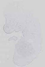 EMAGE:14152