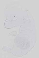 EMAGE:14152