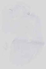 EMAGE:14155
