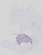 EMAGE:14157