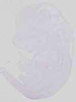 EMAGE:14162