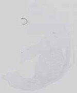 EMAGE:14164