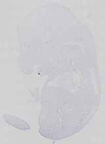 EMAGE:14164
