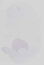 EMAGE:14176