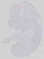 EMAGE:14178