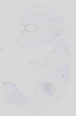 EMAGE:14191