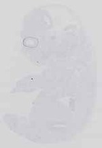 EMAGE:14193