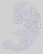 EMAGE:14204