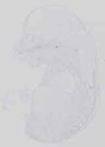 EMAGE:14209