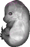 mouse atlas EMAGE spatial in situ gene expression database None