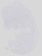 EMAGE:14224