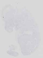EMAGE:14224