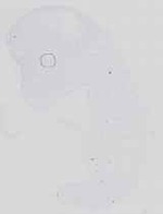EMAGE:14224