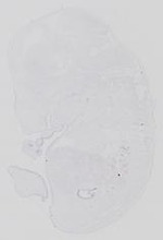 EMAGE:14237
