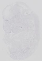 EMAGE:14240