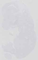 EMAGE:14250