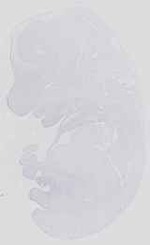 EMAGE:14251