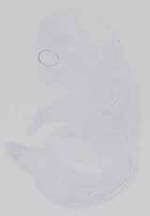 EMAGE:14262