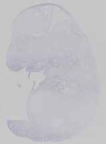 EMAGE:14265