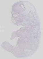 EMAGE:14284