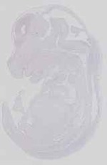 EMAGE:14284