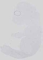 EMAGE:14284